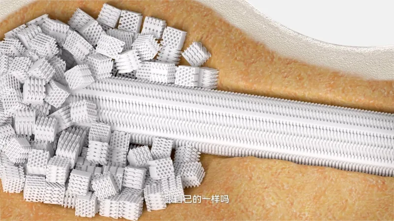 医疗 | 人工骨 | 同光生物