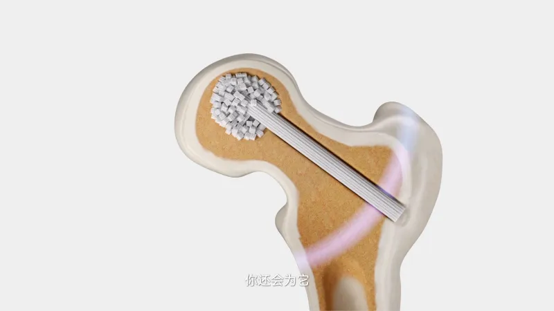 跨越十个月的视觉淬炼：当三维动画叩响医疗创新之门