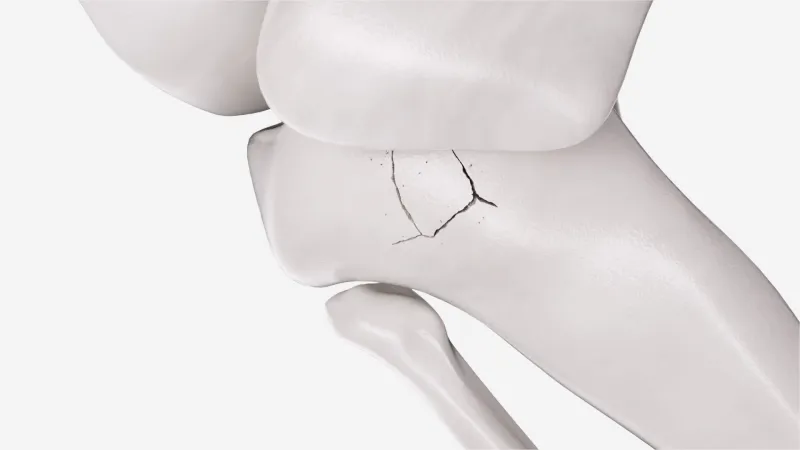 跨越十个月的视觉淬炼：当三维动画叩响医疗创新之门