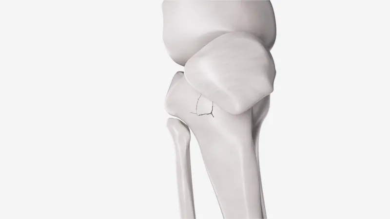 跨越十个月的视觉淬炼：当三维动画叩响医疗创新之门