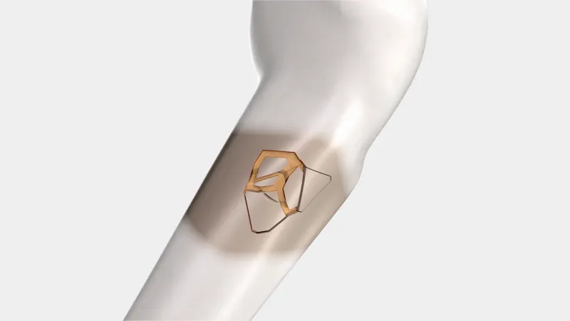 跨越十个月的视觉淬炼：当三维动画叩响医疗创新之门